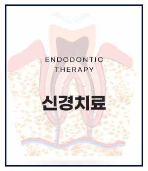 신경치료
