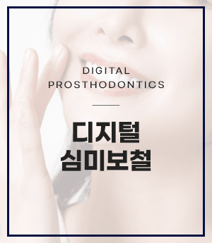 디지털 심미보철